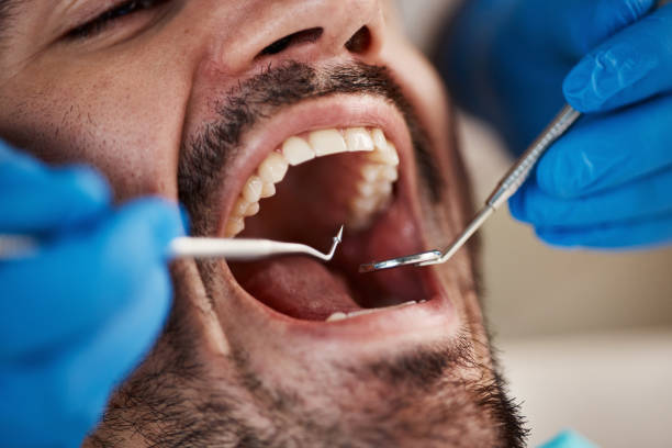 Best Emergency Root Canal Treatment in Normandy Park, WA