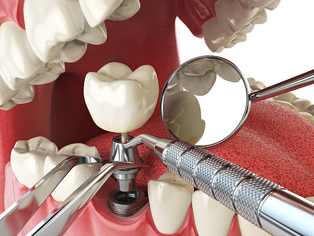 Best Emergency Dentist for Special Needs Patients in Normandy Park, WA